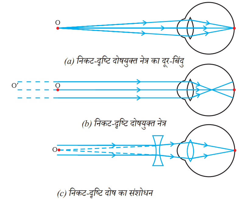 avatal lens