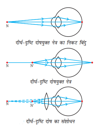 uttal lens